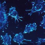 25 Dados estatísticos e curiosidades sobre o Câncer